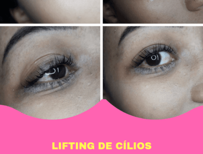 AS VANTAGENS DE FAZER LIFTING DE CÍLIOS