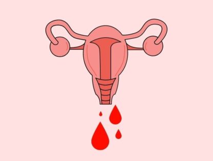 Pobreza menstrual no Brasil é uma dura realidade