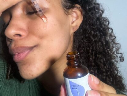Como evitar espinhas: 10 cuidados importantes com a pele