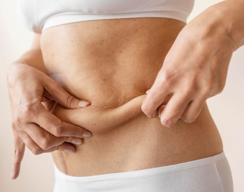 Como Eliminar a Flacidez sem Cirurgia O Novo Segredo da Pele Firme