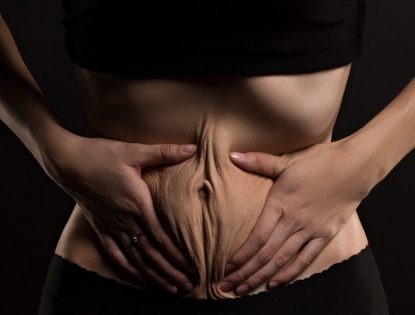 Como Eliminar a Flacidez sem Cirurgia: O Novo Segredo da Pele Firme