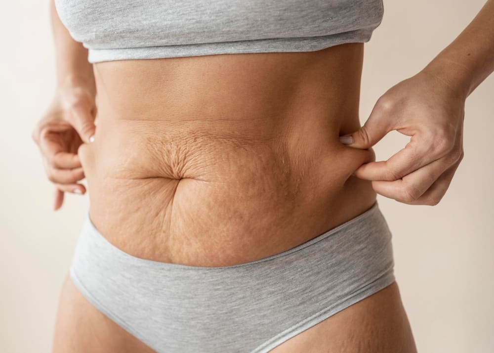 Como Eliminar a Flacidez sem Cirurgia O Novo Segredo da Pele Firme