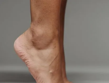 Dor nos pés: veja como cuidar e prevenir lesões