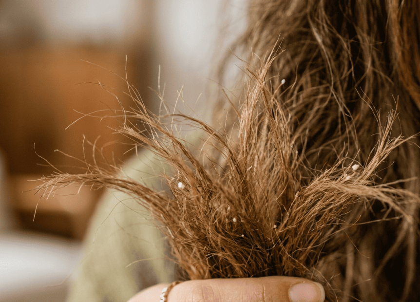 Cabelo que precisa de reconstrução apresenta estes 7 sinais