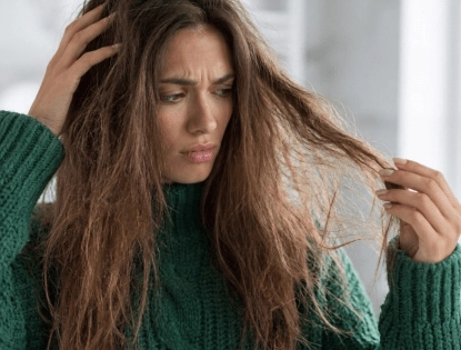 Cabelos ressecados no inverno: 5 produtos indispensáveis