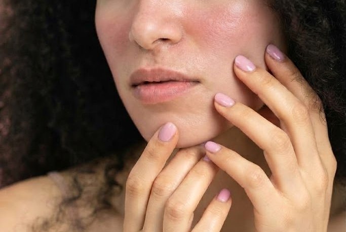 Skin burnout: como identificar os sinais e cuidar da pele esgotada