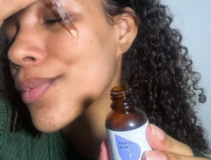 Como evitar espinhas: 10 cuidados importantes com a pele